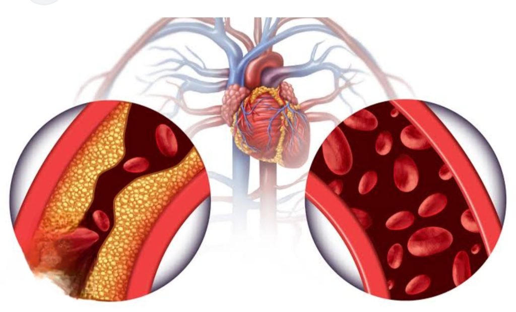 Good cholesterol